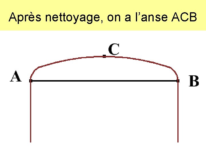 Après nettoyage, on a l’anse ACB 