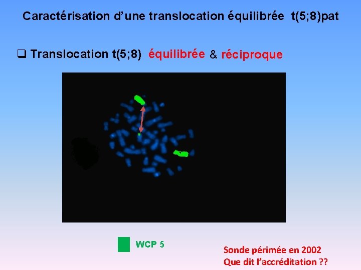 Caractérisation d’une translocation équilibrée t(5; 8)pat q Translocation t(5; 8) équilibrée & réciproque WCP