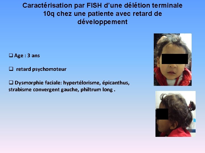 Caractérisation par FISH d’une délétion terminale 10 q chez une patiente avec retard de