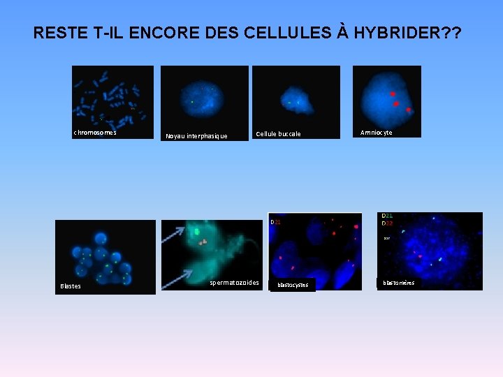 RESTE T-IL ENCORE DES CELLULES À HYBRIDER? ? chromosomes Noyau interphasique Cellule buccale Amniocyte