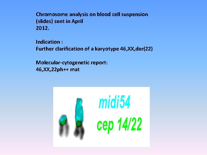 Chromosome analysis on blood cell suspension (slides) sent in April 2012. Indication : Further