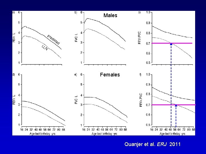 Males Maschi pr ed LL ict ed N Females Femmine Quanjer et al. ERJ