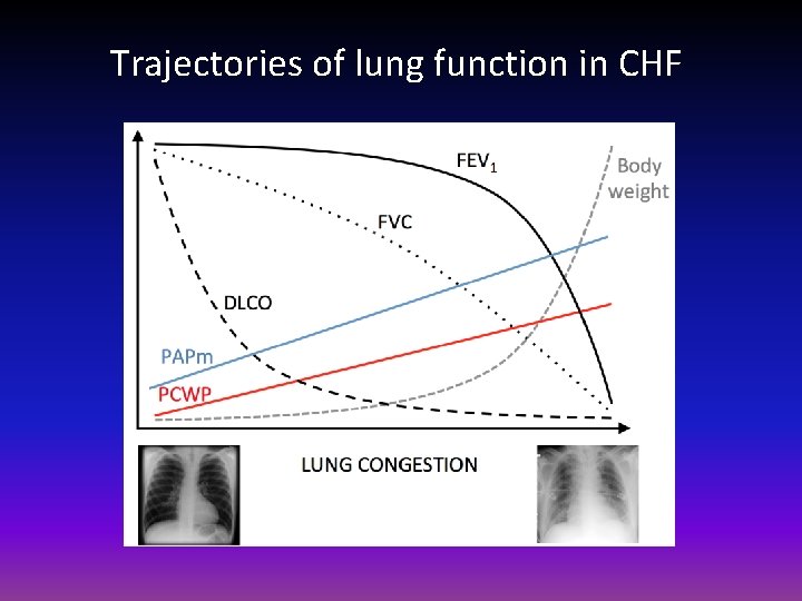 Trajectories of lung function in CHF 