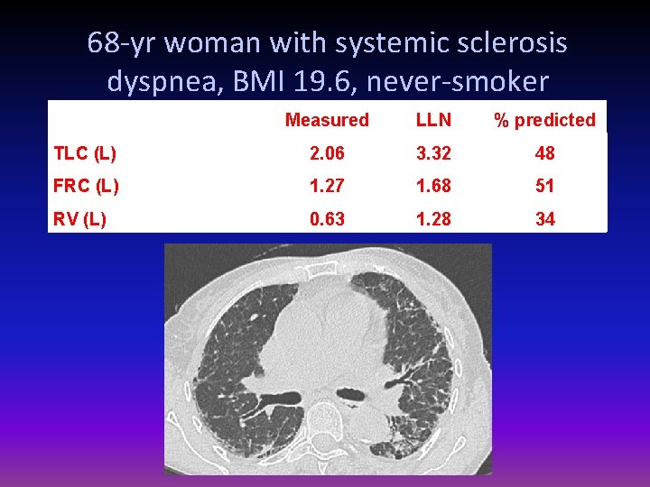 68 -yr woman with systemic sclerosis dyspnea, BMI 19. 6, never-smoker Measured LLN %