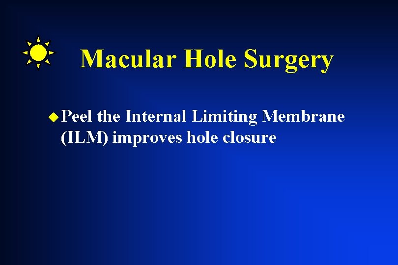 Macular Hole Surgery u Peel the Internal Limiting Membrane (ILM) improves hole closure Macular Hole Surgery u Peel the Internal Limiting Membrane (ILM) improves hole closure