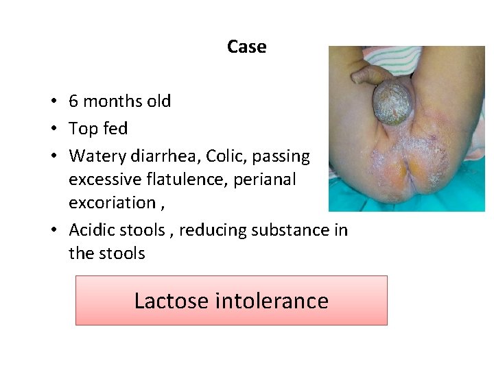 Case • 6 months old • Top fed • Watery diarrhea, Colic, passing excessive