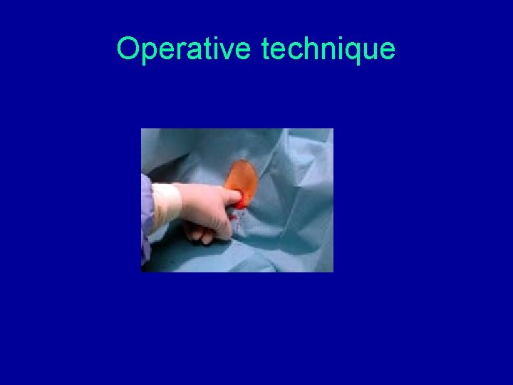 Operative technique Operative technique
