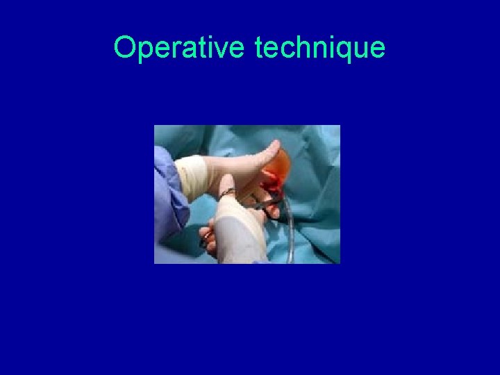 Operative technique Operative technique
