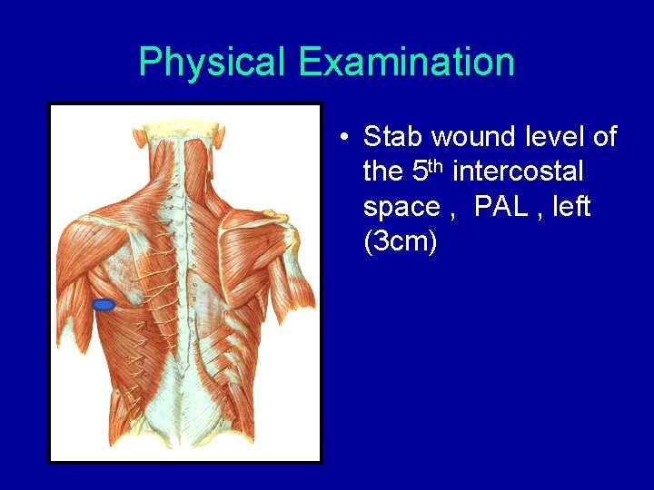 Physical Examination • Stab wound level of the 5 th intercostal space , PAL Physical Examination • Stab wound level of the 5 th intercostal space , PAL