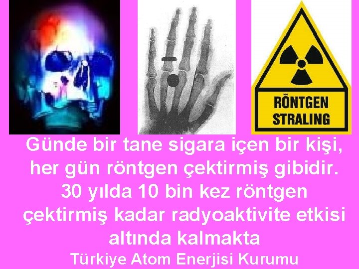 Günde bir tane sigara içen bir kişi, her gün röntgen çektirmiş gibidir. 30 yılda