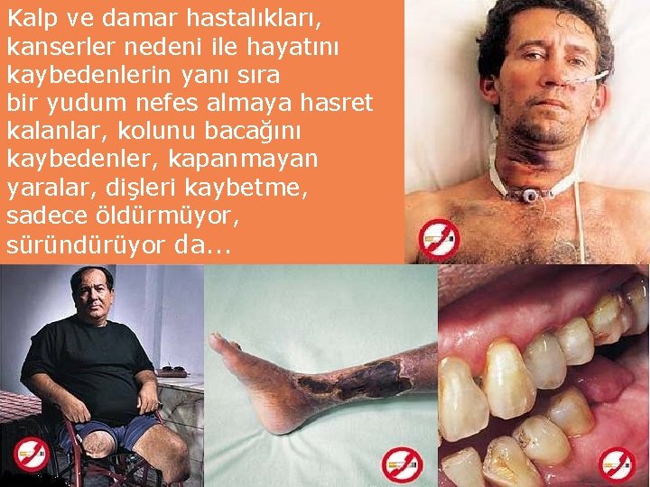 Kalp ve damar hastalıkları, kanserler nedeni ile hayatını kaybedenlerin yanı sıra bir yudum nefes