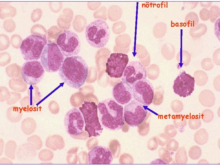 nötrofil basofil myelosit metamyelosit 