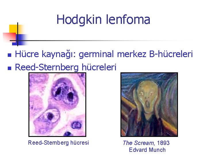 Hodgkin lenfoma n n Hücre kaynağı: germinal merkez B-hücreleri Reed-Sternberg hücresi The Scream, 1893