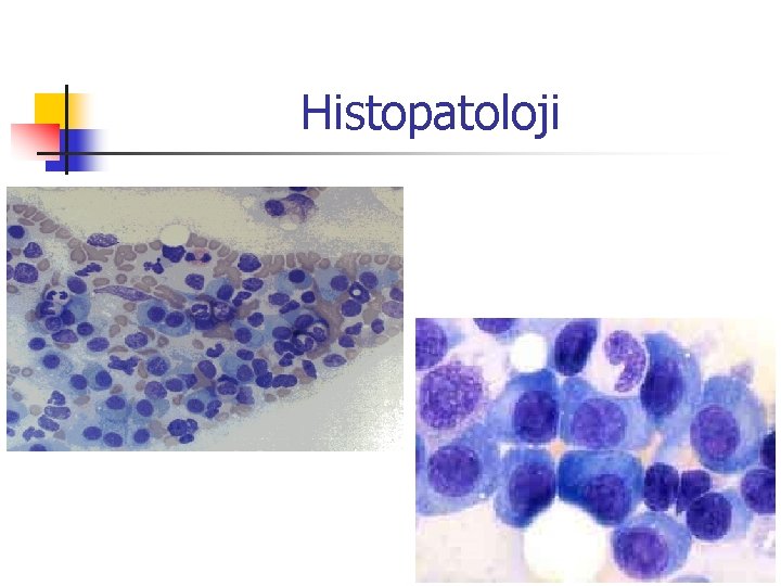 Histopatoloji 