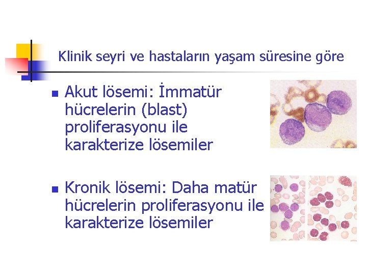 Klinik seyri ve hastaların yaşam süresine göre n n Akut lösemi: İmmatür hücrelerin (blast) Klinik seyri ve hastaların yaşam süresine göre n n Akut lösemi: İmmatür hücrelerin (blast)
