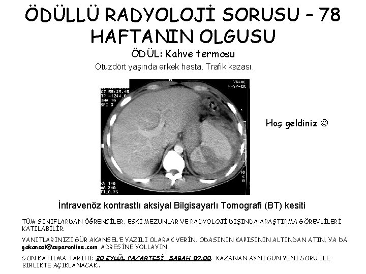 ÖDÜLLÜ RADYOLOJİ SORUSU – 78 HAFTANIN OLGUSU ÖDÜL: Kahve termosu Otuzdört yaşında erkek hasta.