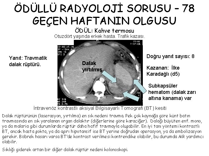 ÖDÜLLÜ RADYOLOJİ SORUSU – 78 GEÇEN HAFTANIN OLGUSU ÖDÜL: Kahve termosu Otuzdört yaşında erkek