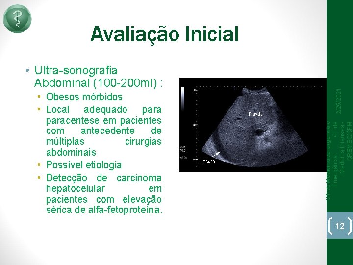 • Obesos mórbidos • Local adequado paracentese em pacientes com antecedente de múltiplas