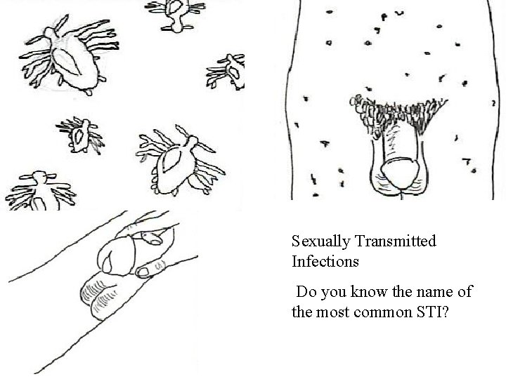 Sexually Transmitted Infections Do you know the name of the most common STI? 