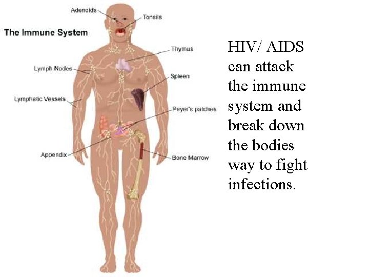 HIV/ AIDS can attack the immune system and break down the bodies way to