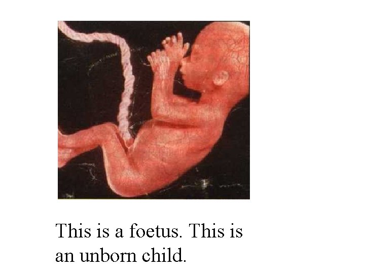 This is a foetus. This is an unborn child. 