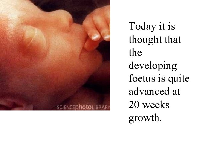 Today it is thought that the developing foetus is quite advanced at 20 weeks