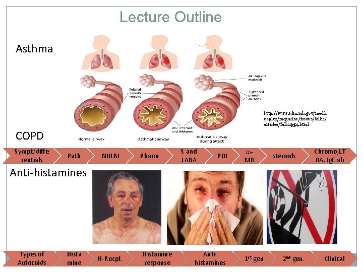 Lecture Outline Asthma http: //www. nlm. nih. gov/medli neplus/magazine/issues/fall 11/ articles/fall 11 pg 4.