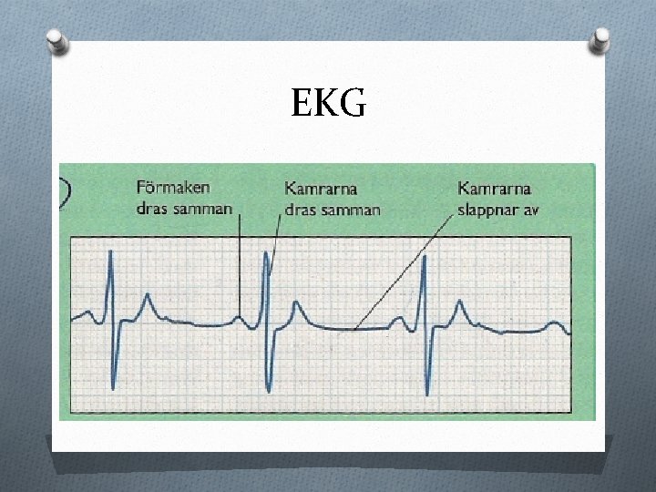 EKG 