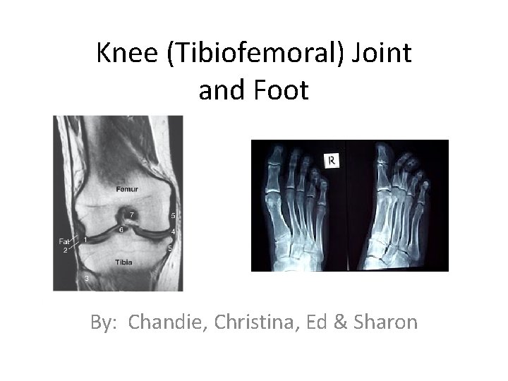 Knee (Tibiofemoral) Joint and Foot By: Chandie, Christina, Ed & Sharon 