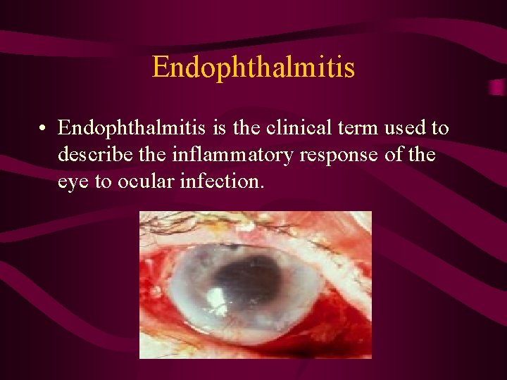 Endophthalmitis • Endophthalmitis is the clinical term used to describe the inflammatory response of