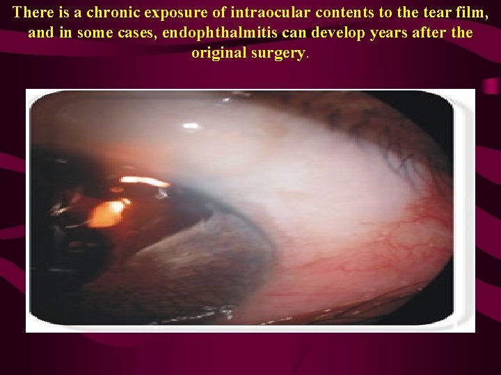 There is a chronic exposure of intraocular contents to the tear film, and in