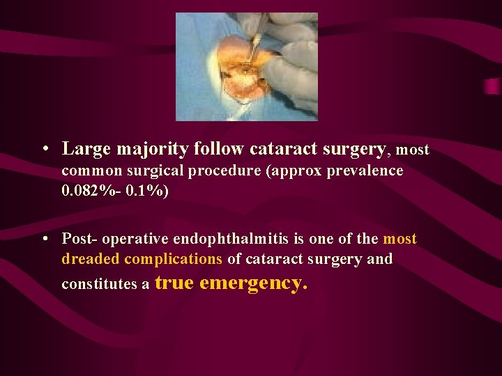  • Large majority follow cataract surgery, most common surgical procedure (approx prevalence 0.