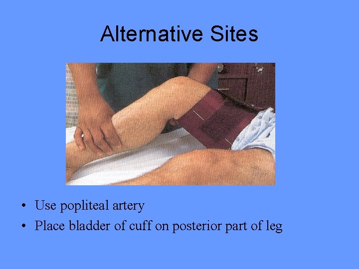 Alternative Sites • Use popliteal artery • Place bladder of cuff on posterior part