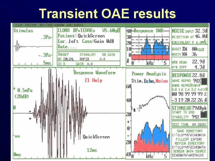 Transient OAE results 