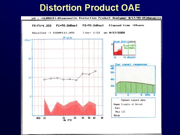 Distortion Product OAE 