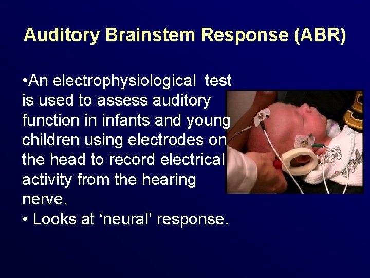 Auditory Brainstem Response (ABR) • An electrophysiological test is used to assess auditory function