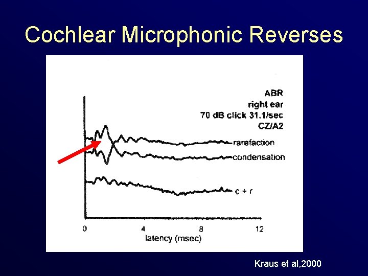 Cochlear Microphonic Reverses Kraus et al, 2000 