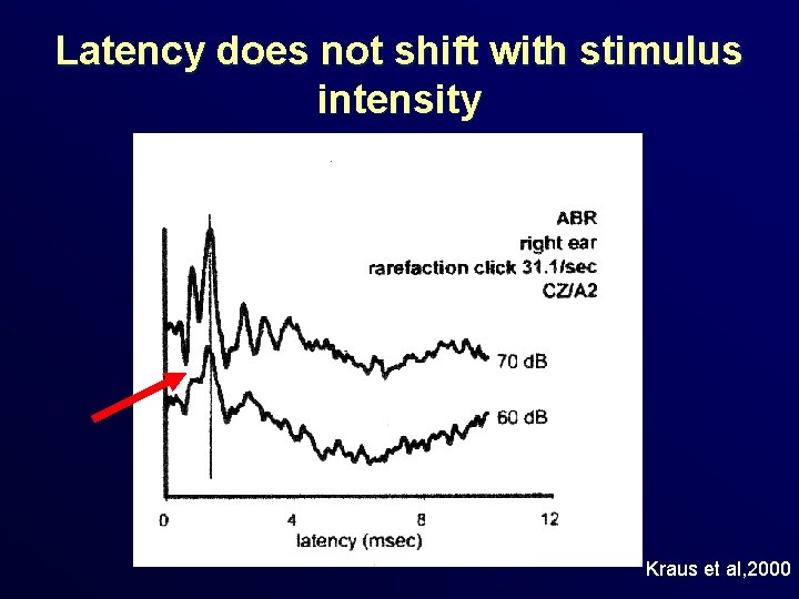 Latency does not shift with stimulus intensity Kraus et al, 2000 