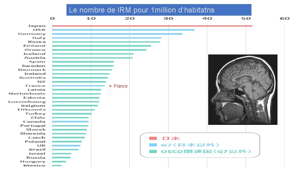 Le nombre de IRM pour 1 million d’habitatns ⇦ France 
