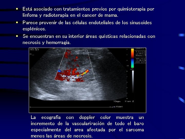§ Está asociado con tratamientos previos por quimioterapia por linfoma y radioterapia en el