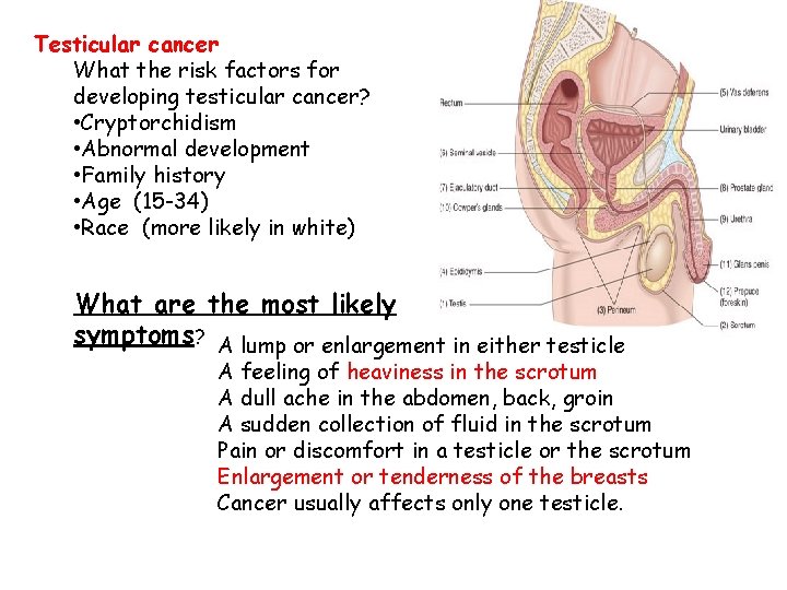 Testicular cancer What the risk factors for developing testicular cancer? • Cryptorchidism • Abnormal