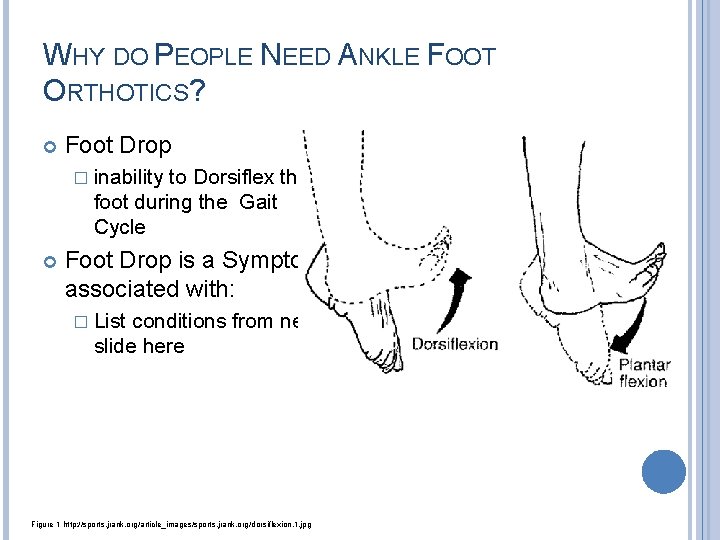 DESIGN OF AN ANKLE FOOT ORTHOTIC Christopher Sullivan