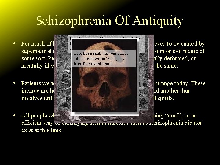 Schizophrenia Of Antiquity • Here lies a patient being water boarded in This is
