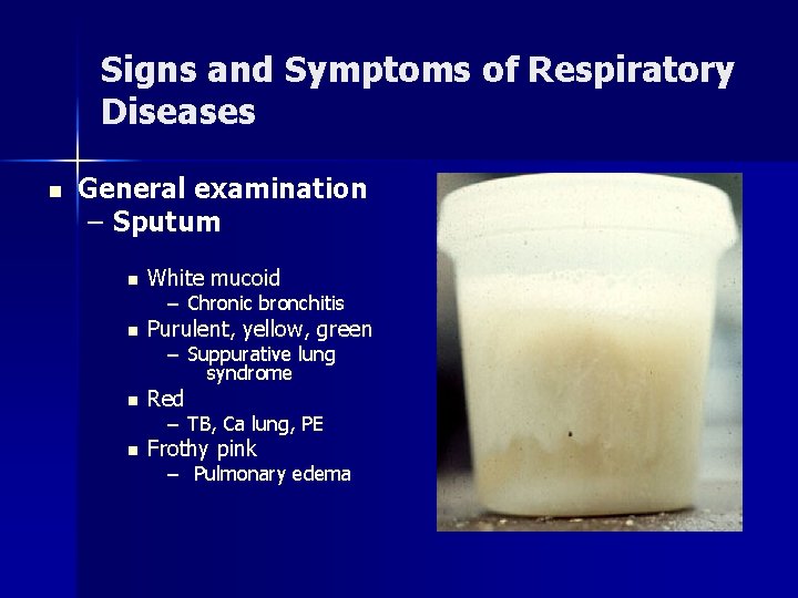 Signs and Symptoms of Respiratory Diseases n General examination – Sputum n White mucoid