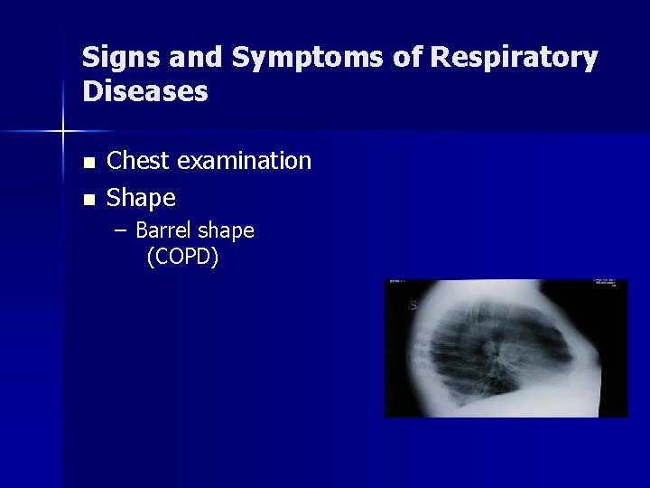 Signs and Symptoms of Respiratory Diseases n n Chest examination Shape – Barrel shape