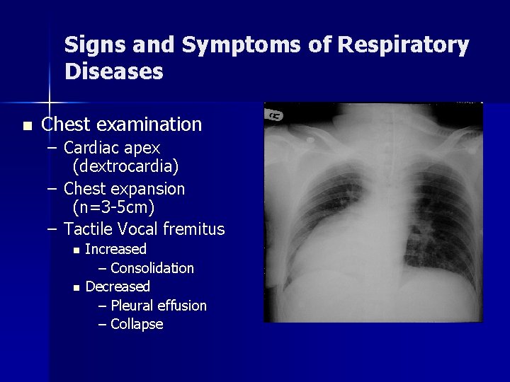 Signs and Symptoms of Respiratory Diseases n Chest examination – Cardiac apex (dextrocardia) –