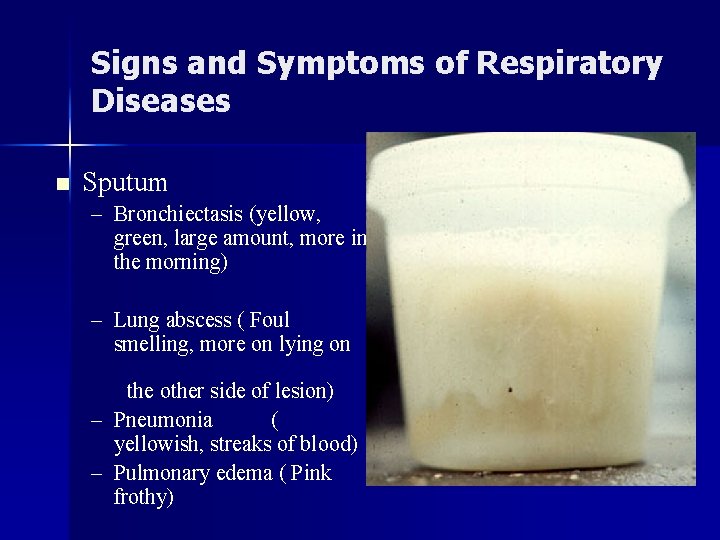 Signs and Symptoms of Respiratory Diseases n Sputum – Bronchiectasis (yellow, green, large amount,