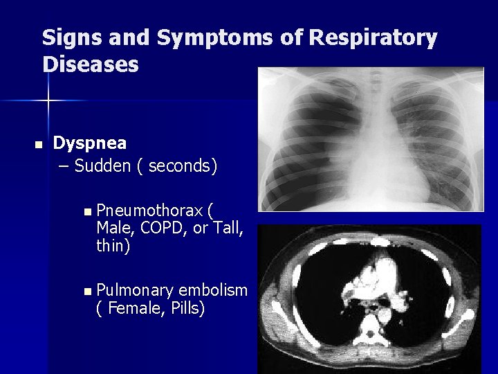 Signs and Symptoms of Respiratory Diseases n Dyspnea – Sudden ( seconds) n Pneumothorax