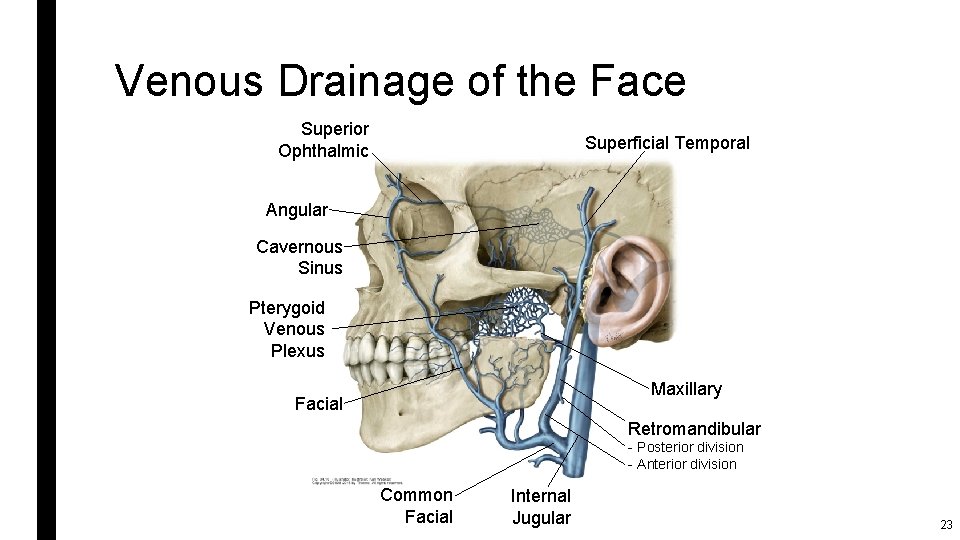Venous Drainage of the Face Superior Ophthalmic Superficial Temporal Angular Cavernous Sinus Pterygoid Venous