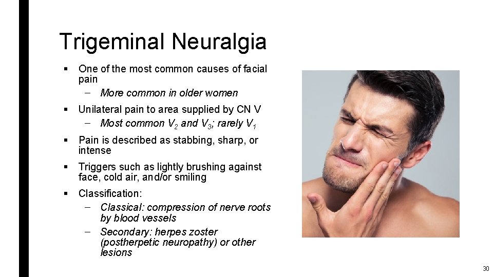 Trigeminal Neuralgia § One of the most common causes of facial pain – More